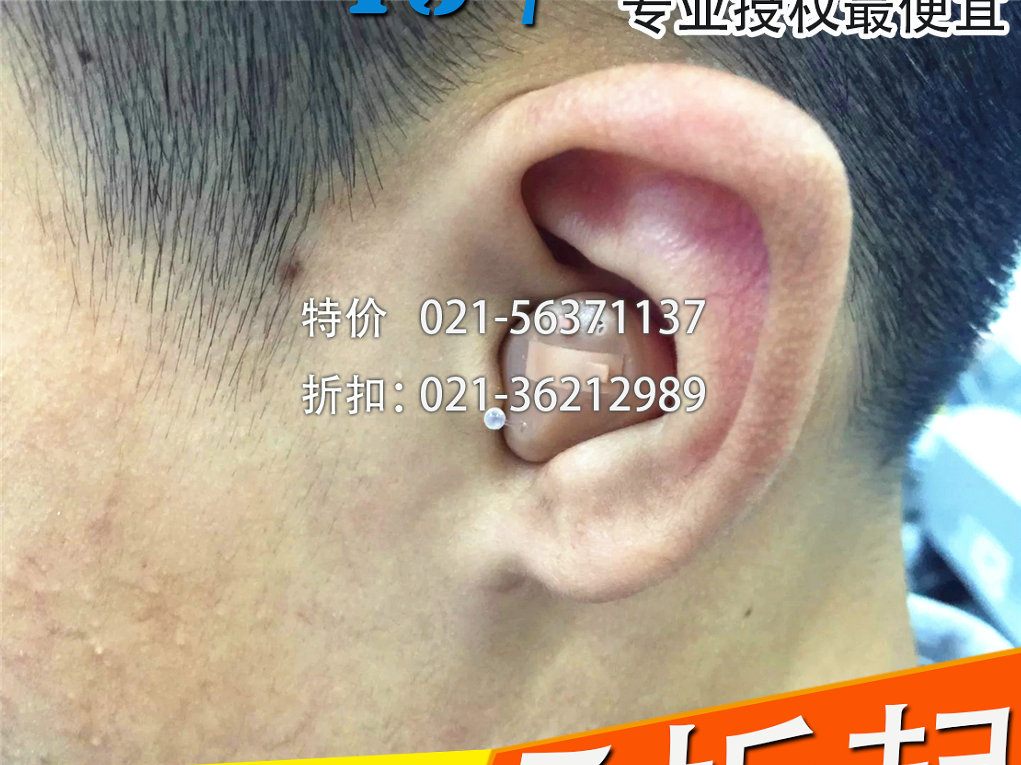 普陀峰力助聽(tīng)器系列價(jià)格