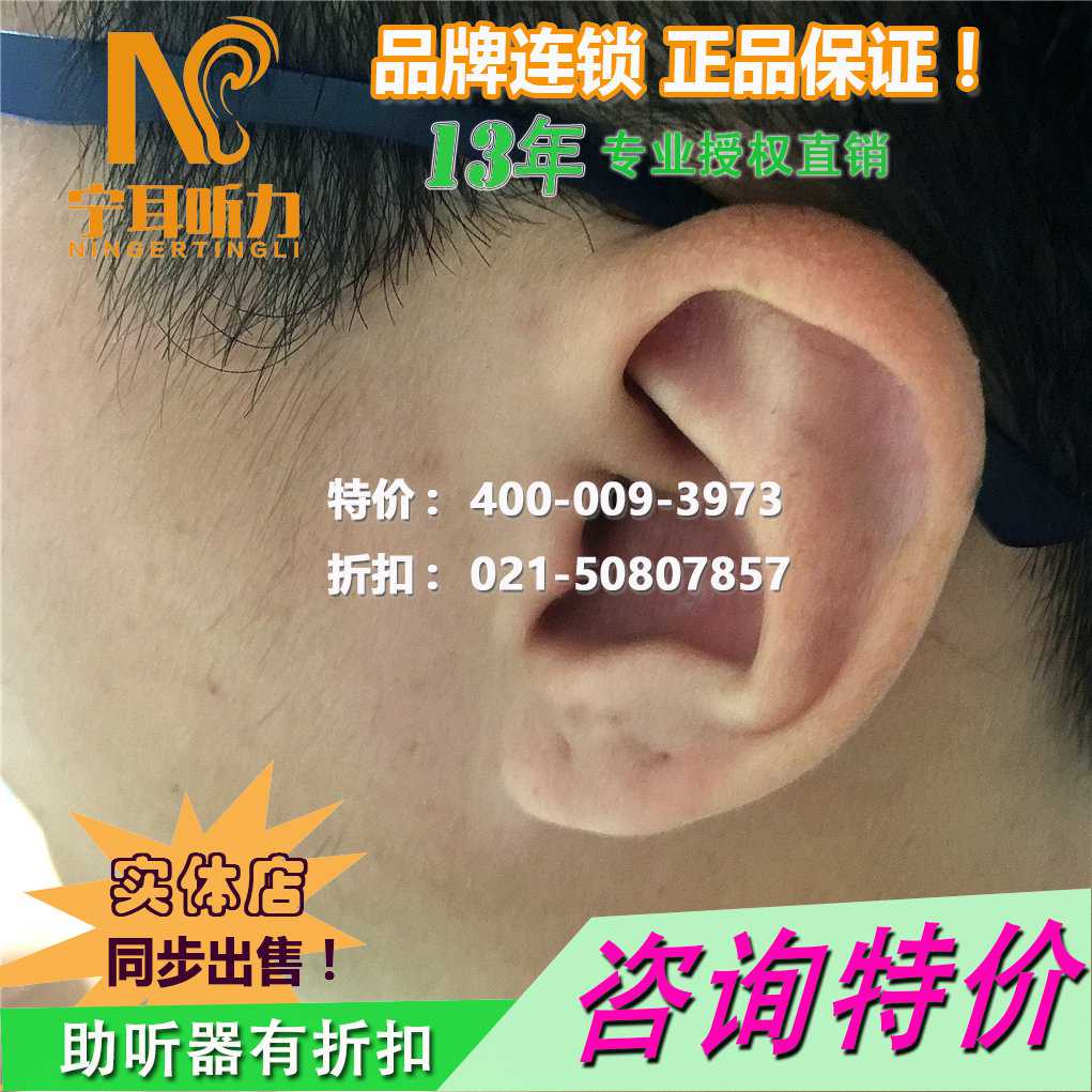 上海靜安西門子助聽器驗配中心