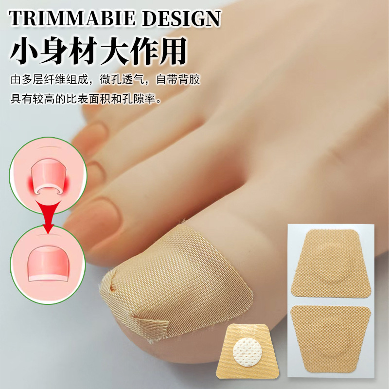 正甲貼嵌甲矯正貼腳趾甲溝內(nèi)卷修復(fù)拉拉貼廠家指甲糾正貼軟甲套裝